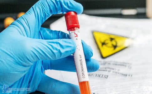 cd736b1-c97b040-coronavirus-covid-19-tube-test-233-chantillon-main-positif-1211795483-scaled-1